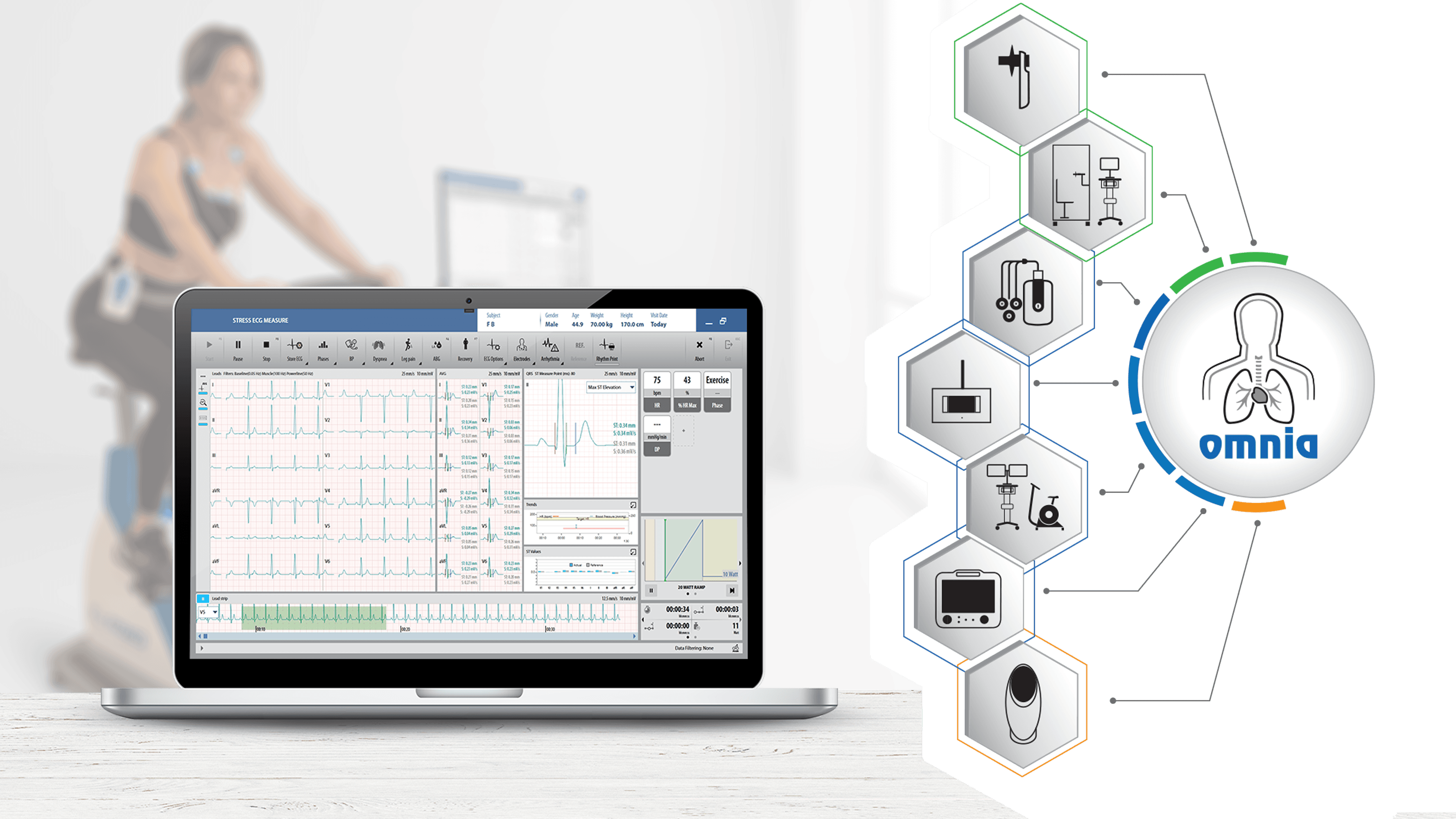 Refertazione di un tracciato ECG nel software OMNIA di COSMED